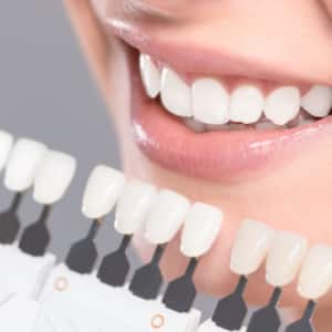 feature-img-veneers